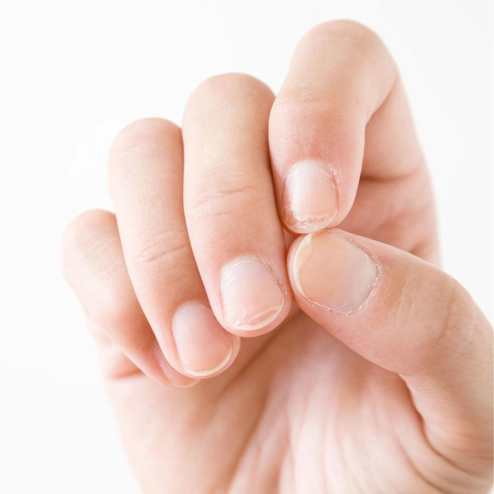 Is it possible to reverse vertical nail ridges? - Quora
